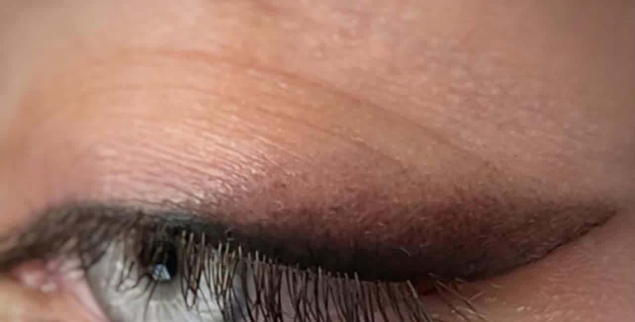 Permanent eyeliner seen with the eye open and relaxed